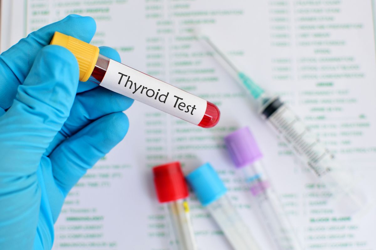 myLAB Box Comprehensive Thyroid Test: Your At-Home Solution for Thyroid Health