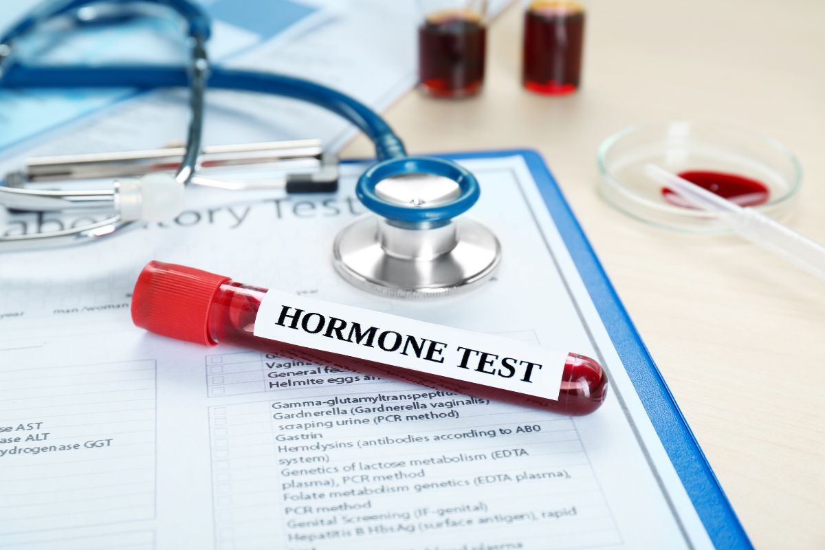 Unveiling the myLAB Box Men’s Health Test: Your At-Home Hormone Check